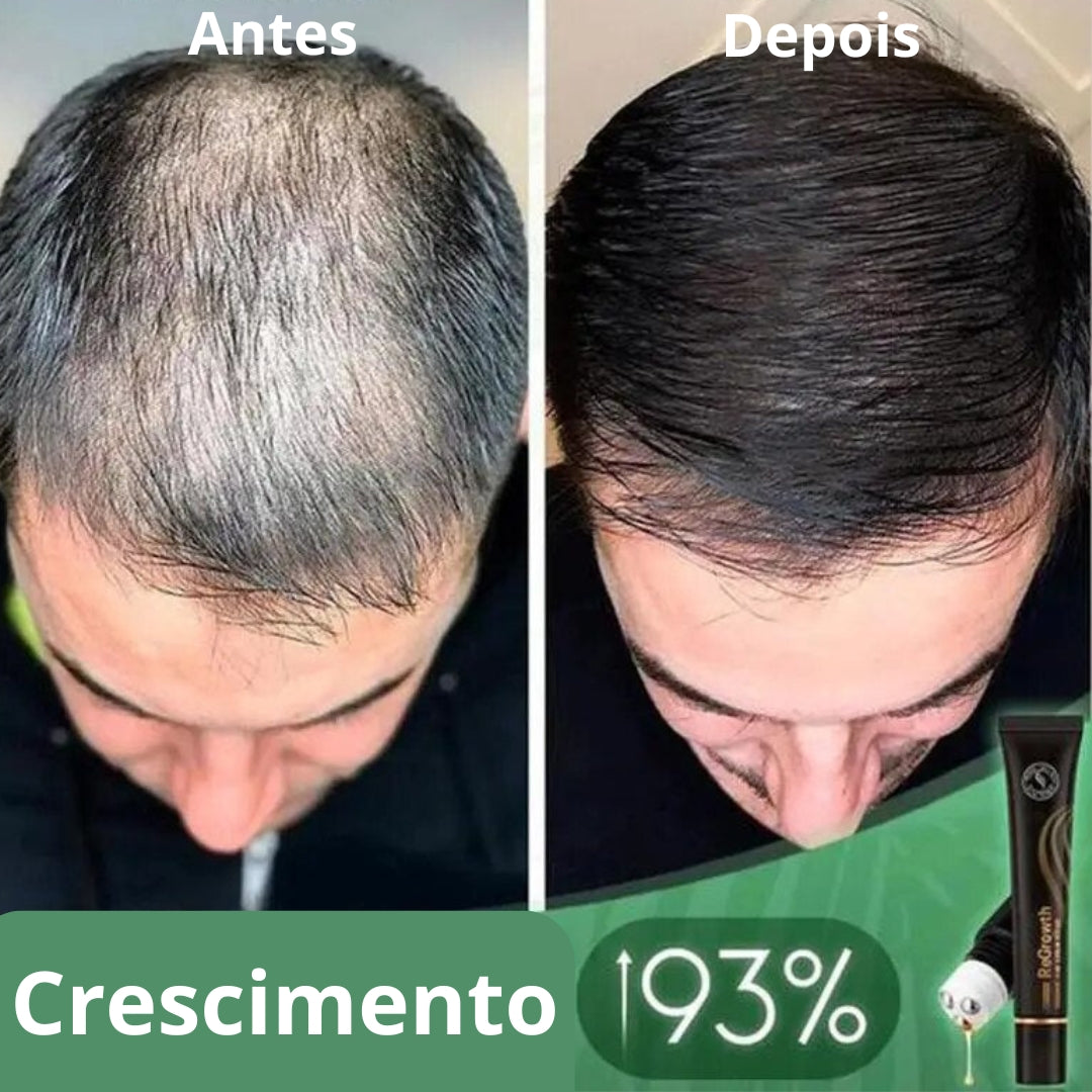 Derma-Hair-Serum-de-Restauração-Capilar-100%-Natural 