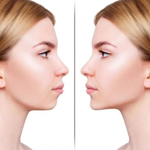 Adesivos faciais de levantamento invisíveis, remendo facial fino transparente, ferramentas em forma de V, rugas de dobras na pele, fita adesiva, fita de lifting invisível